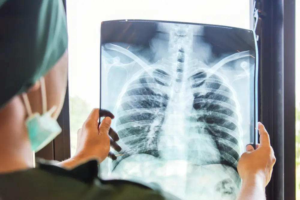 x-rays-diagnostics