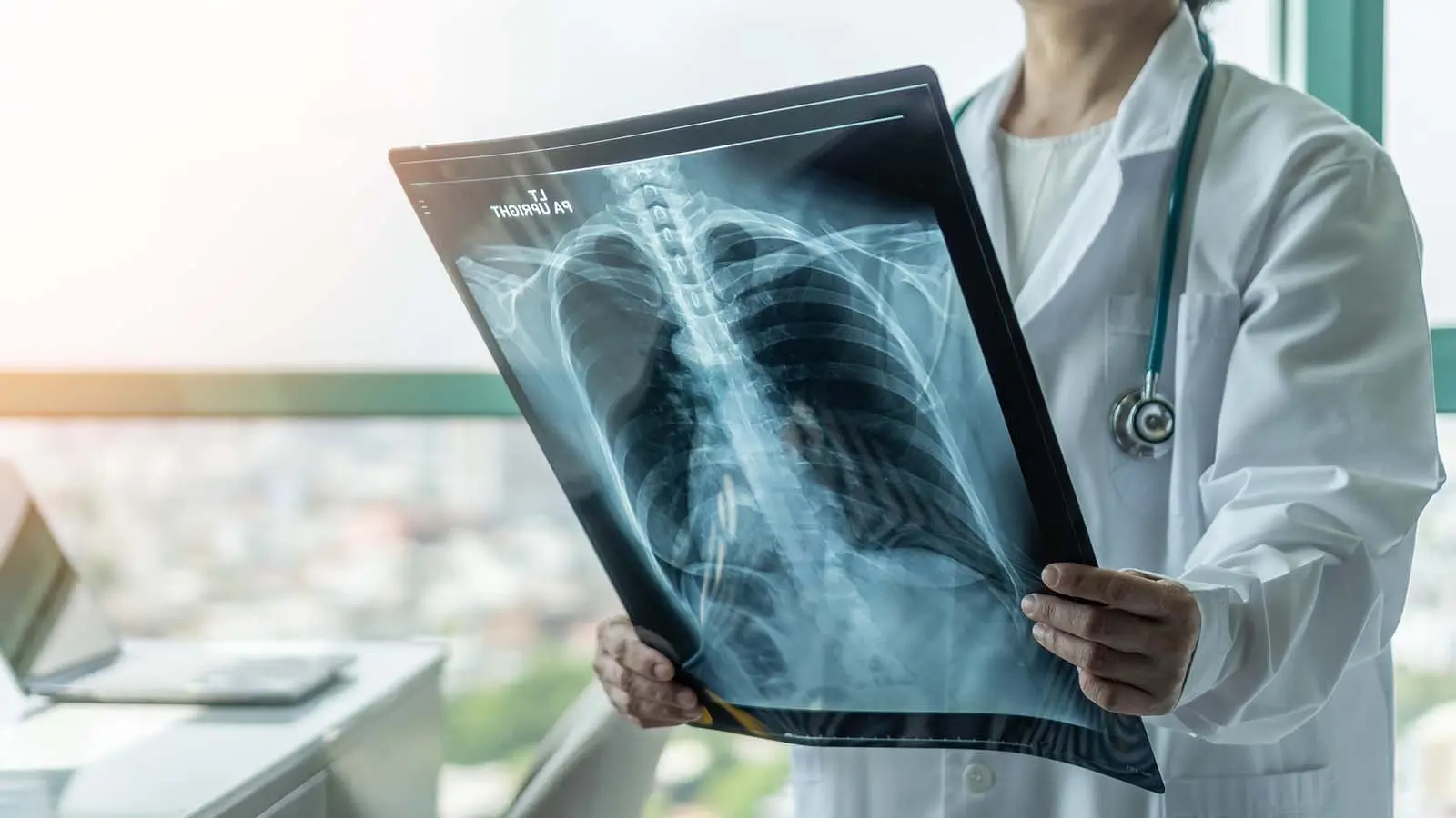 xray